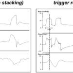 ¿qué significa trigger en medicina?